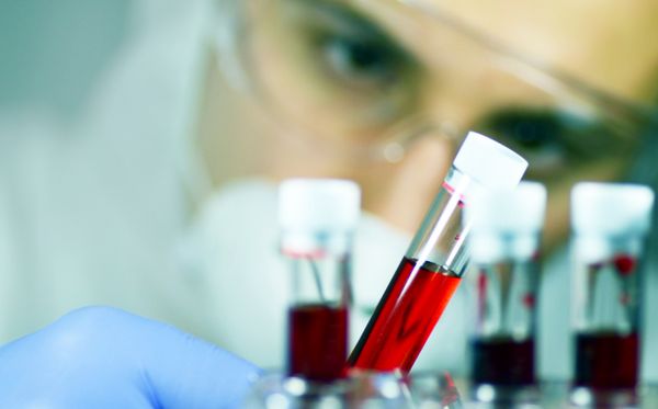 blood test | Image credit: barbol - stock.adobe.com