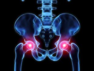 Rate of Osteoporosis Drug Treatment to Prevent Recurrent Fractures Dropping