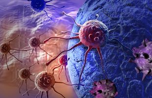 People Living With HIV Have Higher Risk of First and Second Primary Cancer Incidence