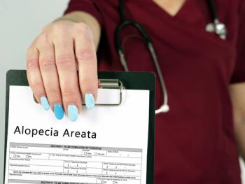 The new data are from one of 2 pivotal phase 3 trials designed to study the safety and efficacy of upadacitinib in adults and adolescents with severe AA.  | Image Credit: Yurii Kibalnik - stock.adobe.com 