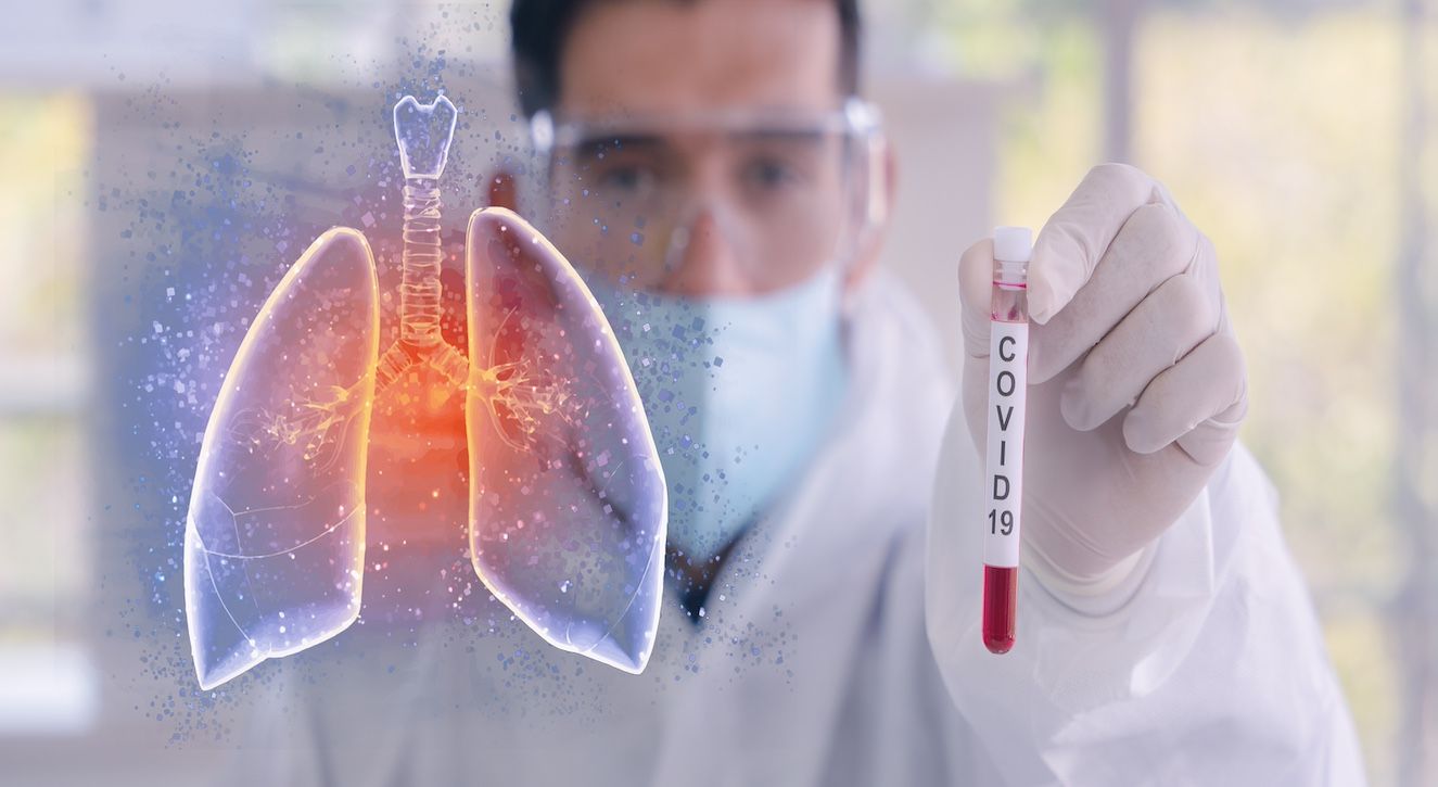 Image of lungs and a doctor with a vial labelled COVID-19 | Image credit: Image credit: Mongkolchon - stock.adobe.com