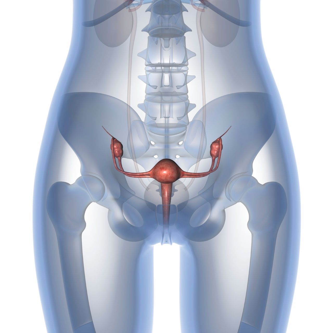 How Does the Risk of HIV-1 Increase With Female Genital Schistosomiasis Infection?