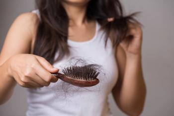Alopecia Image Credit: Siam - stock.adobe.com.jpeg