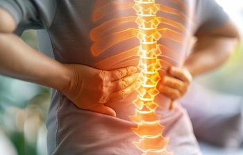 In the pooled analysis, ankylosing spondylitis was associated with a greater risk of cancer occurrence. | Image credit: Lila Patel - stock.adobe.com