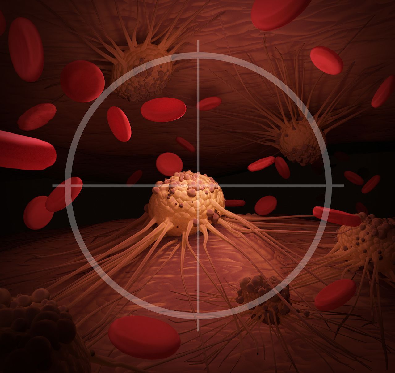 Immunohistochemistry, Flow Cytometric Immunophenotyping Used in Subset of Lymphoplasmacytic Lymphoma