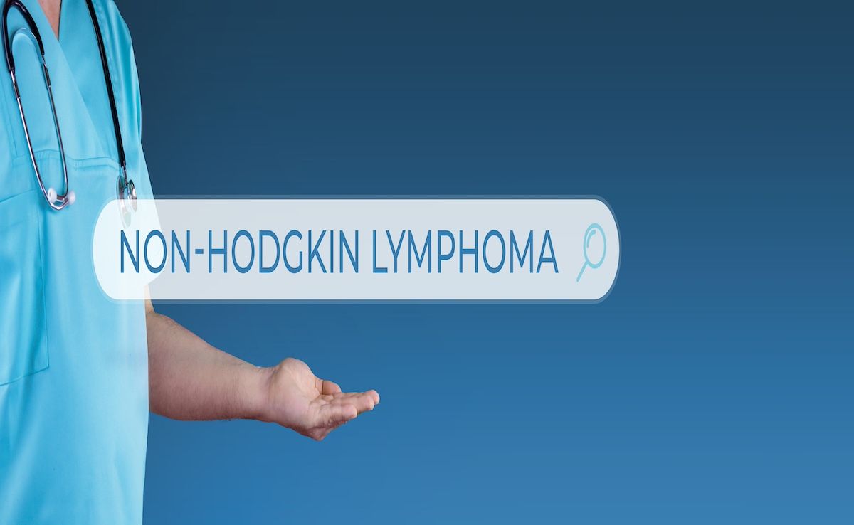 Non-Hodgkin Lymphoma | Image Credit: © MQ-Illustrations - stock.adobe.com