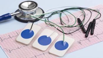 New AI-enhanced echocardiogram model, EchoNext, outperformed cardiologists for accuracy when identifying structural heart disease. | Image credit: Image of an ECG.jpeg