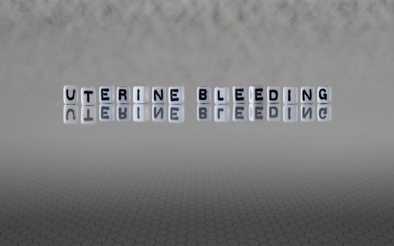 uterine bleeding word or concept represented by black and white letter cubes on a grey horizon background stretching to infinity: © lexiconimages - stock.adobe.com