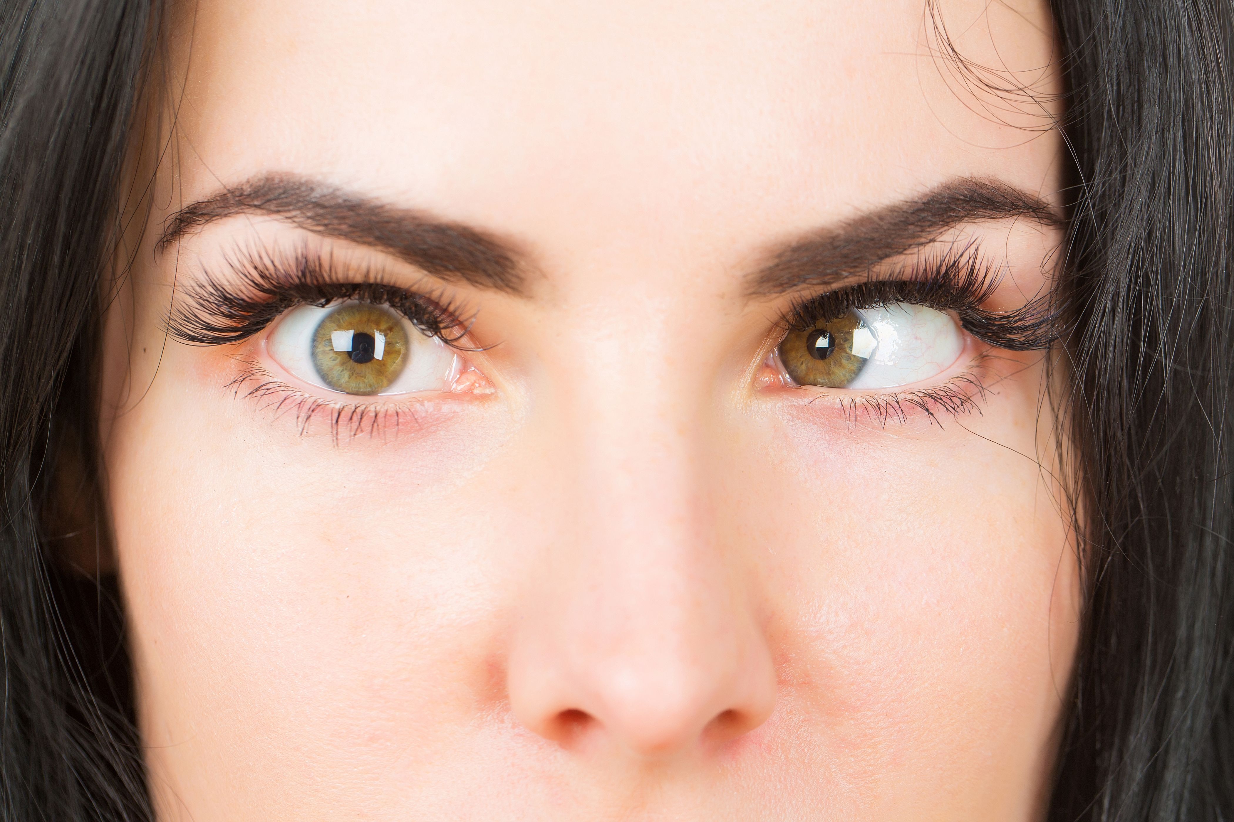 Woman with strabismus | Image credit: Volodymyr - stock.adobe.com