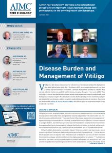 Disease Burden and Management of Vitiligo