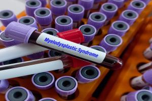 MDS blood test | Image credit: MdBabul - stock.adobe.com