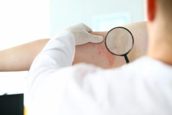 doctor looking at a patient's atopic dermatitis