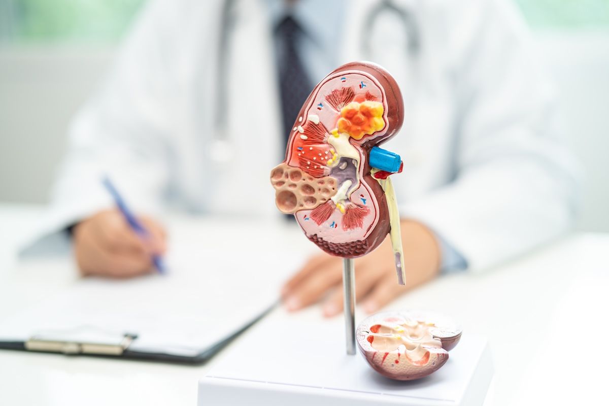 Kidney models doctor - amazing studio - stock.adobe.com.jpeg