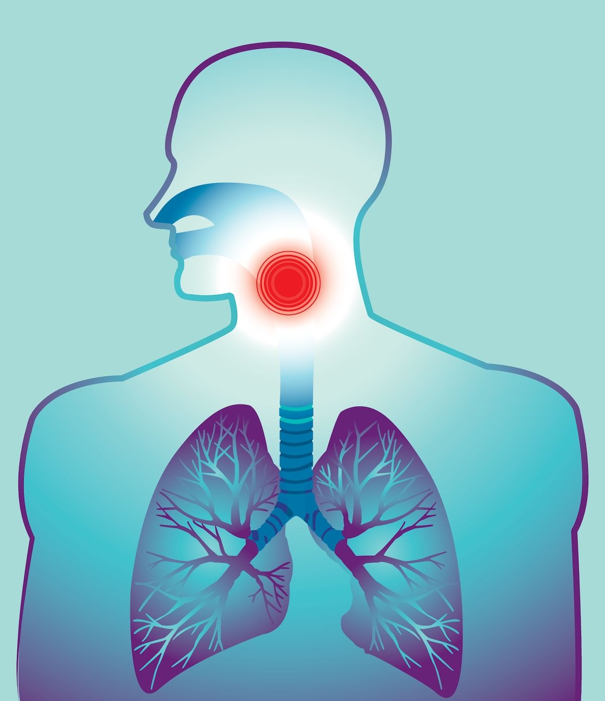 Graphic of lung and throat