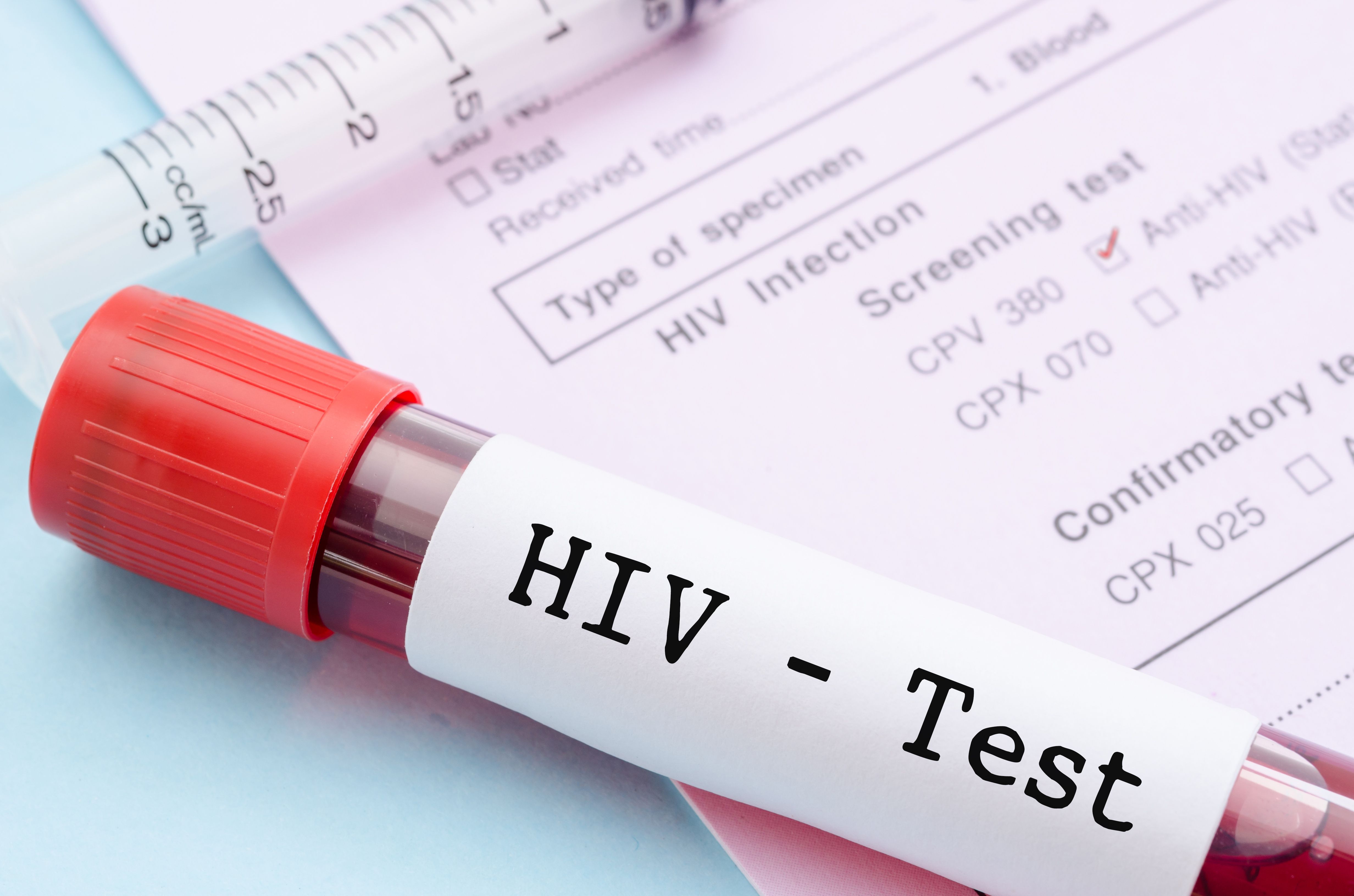 HIV test | Image credit: gamjai - stock.adobe.com
