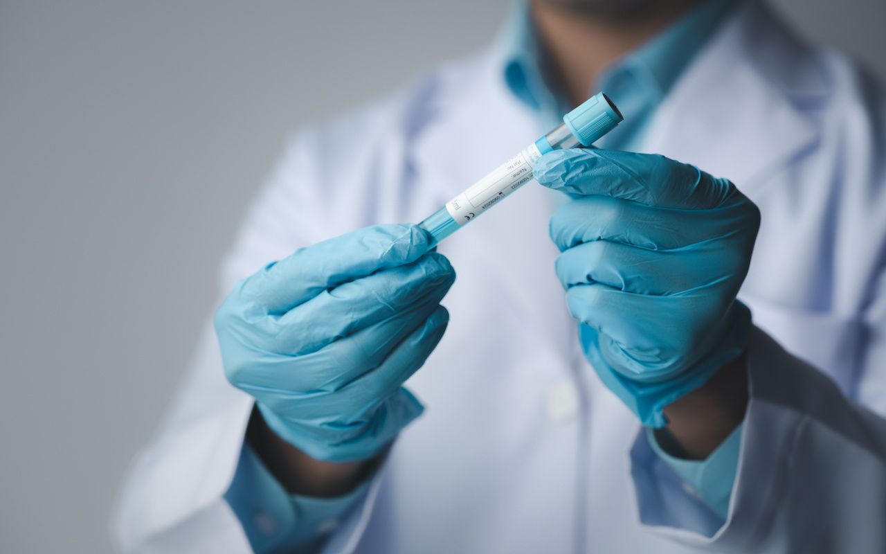 Lab assistant, a medical scientist, a chemistry researcher holds a glass tube through the blood sample, does a chemical experiment and examines a patient's blood sample. Medicine and research concept: © PhotosD - stock.adobe.com