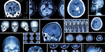 brain image 