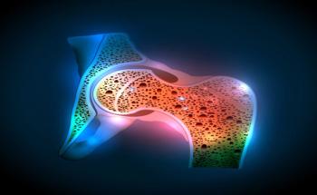 osteoporosis | Image Credit: reineg-stock.adob.ecom