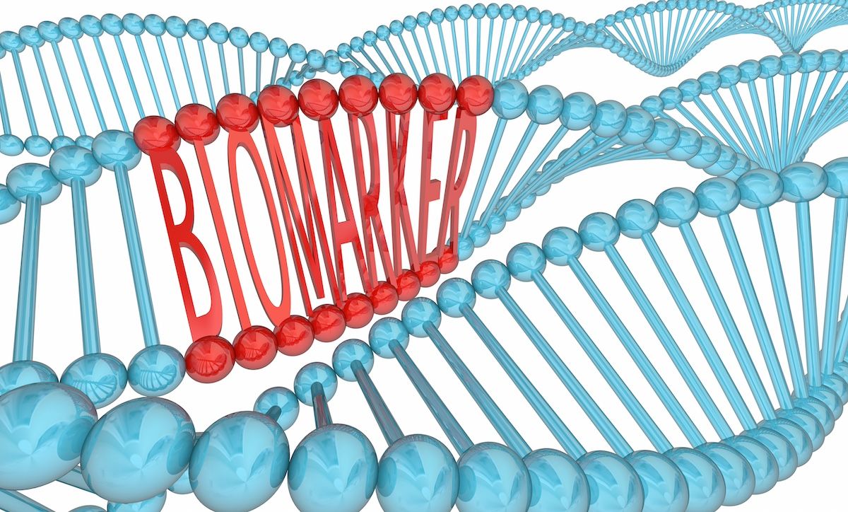 Biomarker DNA Strand Medical Research | Image Credit: iQoncept - stock.adobe.com