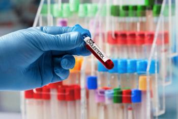 Technician holding tube with label Cholesterol in the blood bank laboratory. Doctor hand taking a blood sample tube from a rack in the lab | Image credit: angellodeco - stock.adobe.com