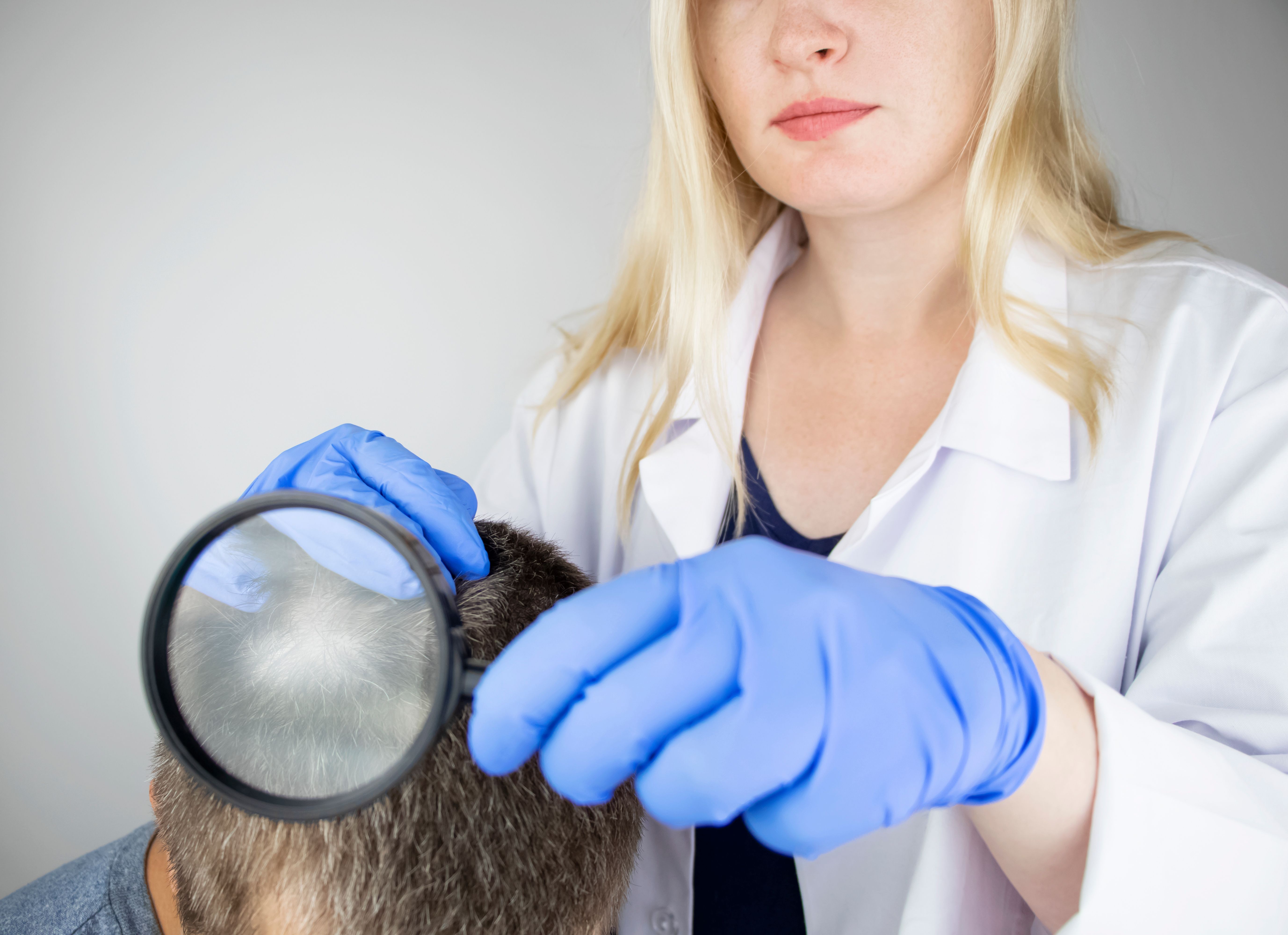 Alopecia areata examined. | Image Credit:  Siniehina - stock.adobe.com