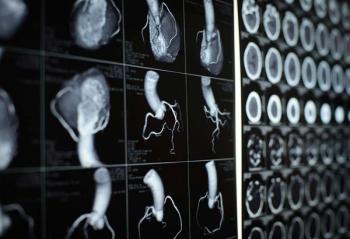 Cardiac CT scan | Image credit: Cleveland Clinic