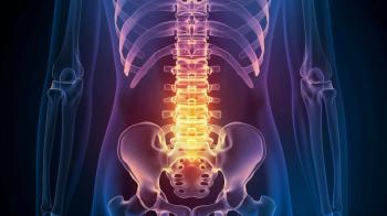 Findings suggest checking regular radiographs in clinical practice for loss of bone density or VFs can be helpful in managing axial spondyloarthritis. - Mutshino_Artwork - stock.adobe.com