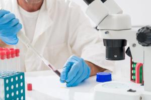 The results support the concept that noninvasive tests may serve as meaningful indicators of treatment response and fibrosis improvement in MASH. | Image credit: luchschenF - stock.adobe.com