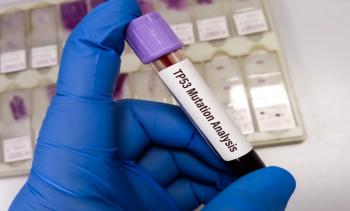 In chronic lymphocytic leukemia (CLL), TP53 has been an important subject of investigation since the early 1990s. | Image credit: MdBabul - stock.adobe.com