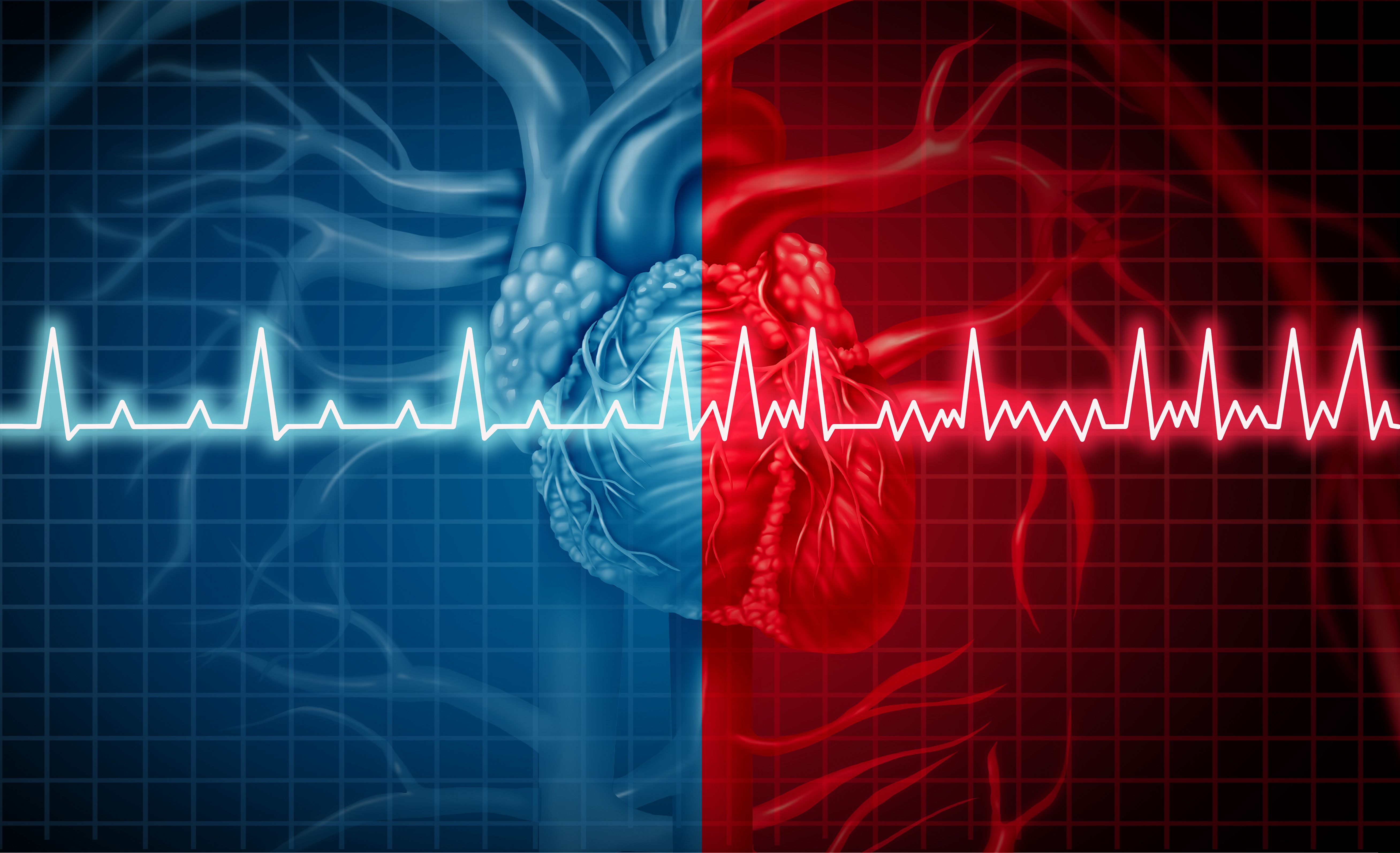 Atrial fibrillation model | image credit: freshidea - stock.adobe.com