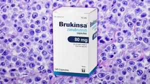 Even After 6 Years, Disease Progression Impacts Survival in Mantle Cell Lymphoma