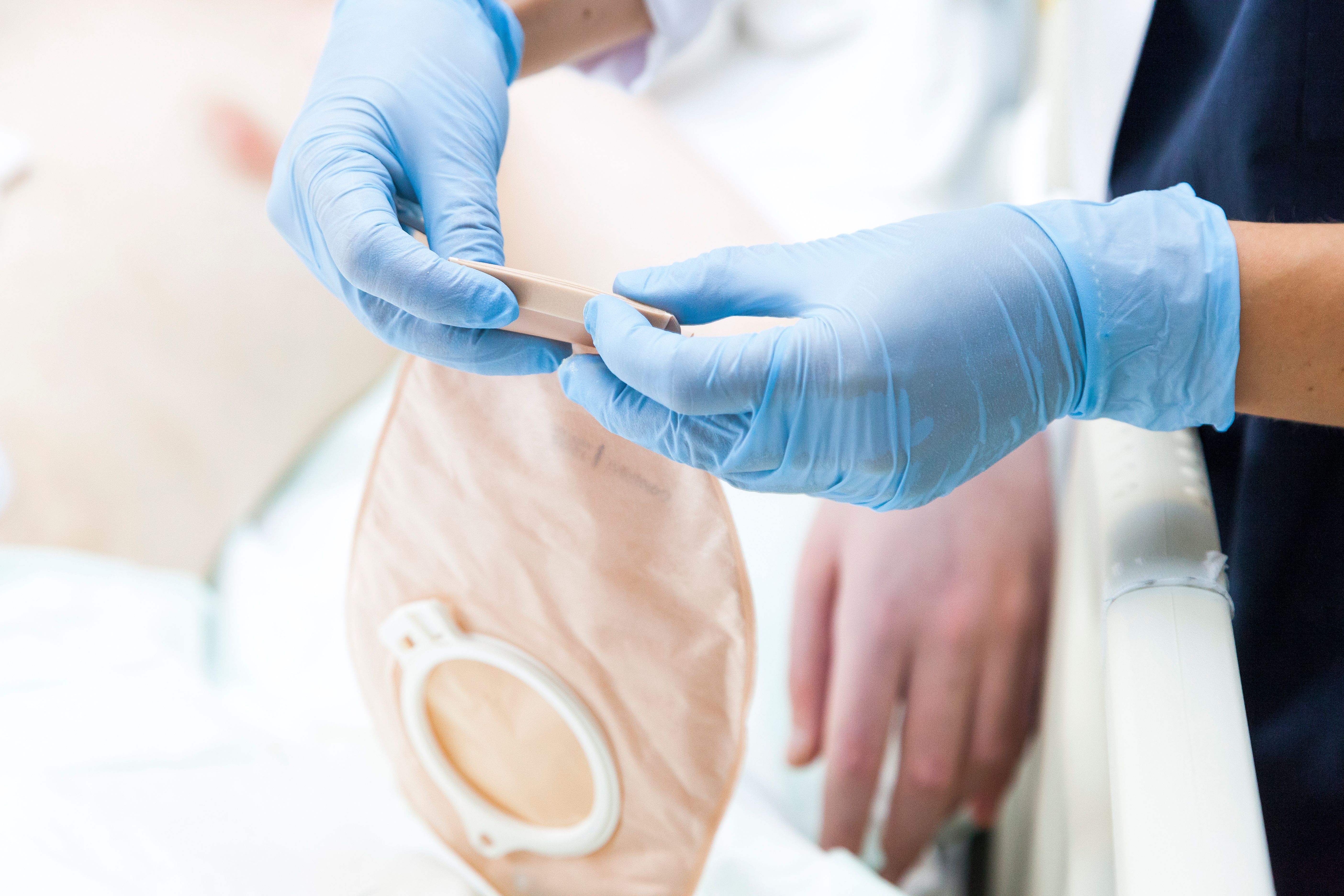 CRC surgery | Image credit: MedicalWorks - stock.adobe.com