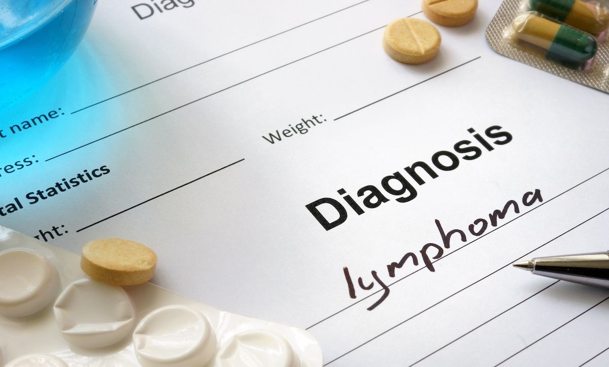 DA-EPOCH-Rituximab: Successfully Treating PMBCL in a Transgender Woman DA-EPOCH-Rituximab: Successfully Treating PMBCL in a Transgender Woman