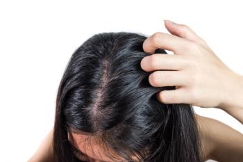 Woman with scalp itch | Small fish - stock.adobe.com
