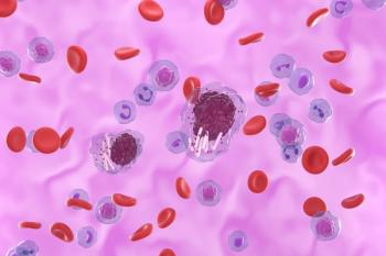 The rapid and durable disease reduction observed, even in the context of bulky, aggressive, and chemoresistant disease, suggests epcoritamab could be a valuable treatment option for patients with DLBCL-RS with limited response to conventional chemotherapy. | Image credit: Laszlo - stock.adobe.com