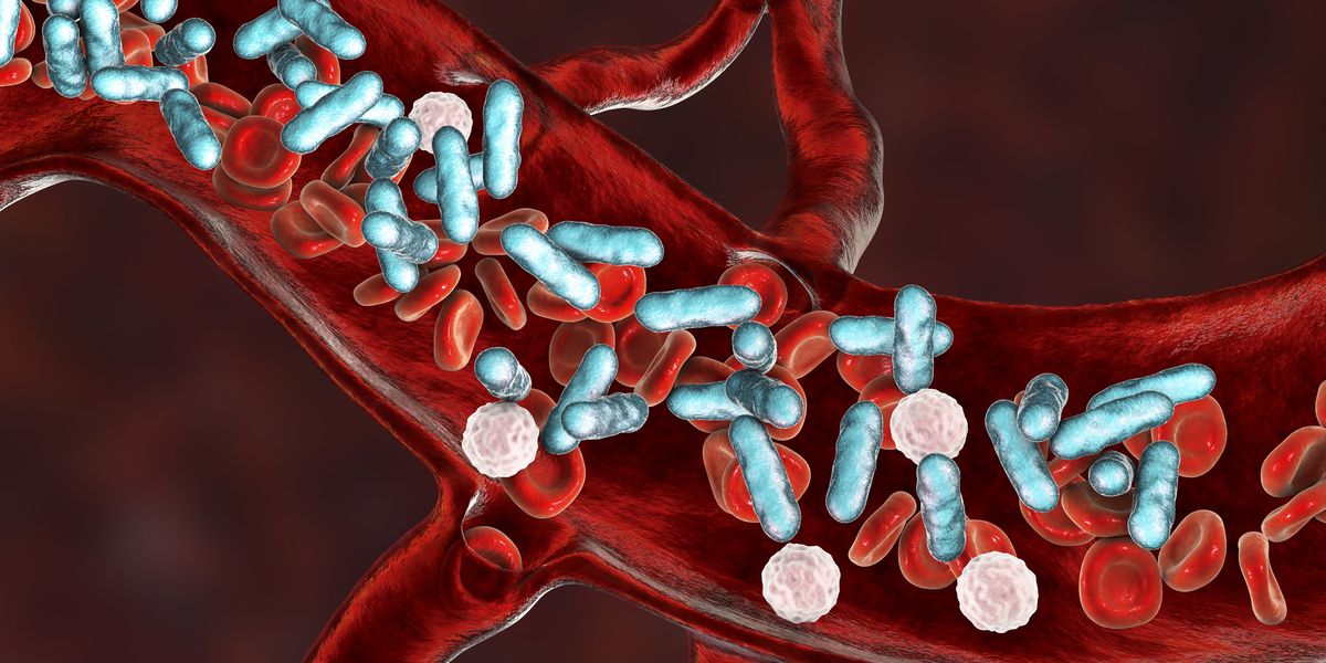 Image of septic infection