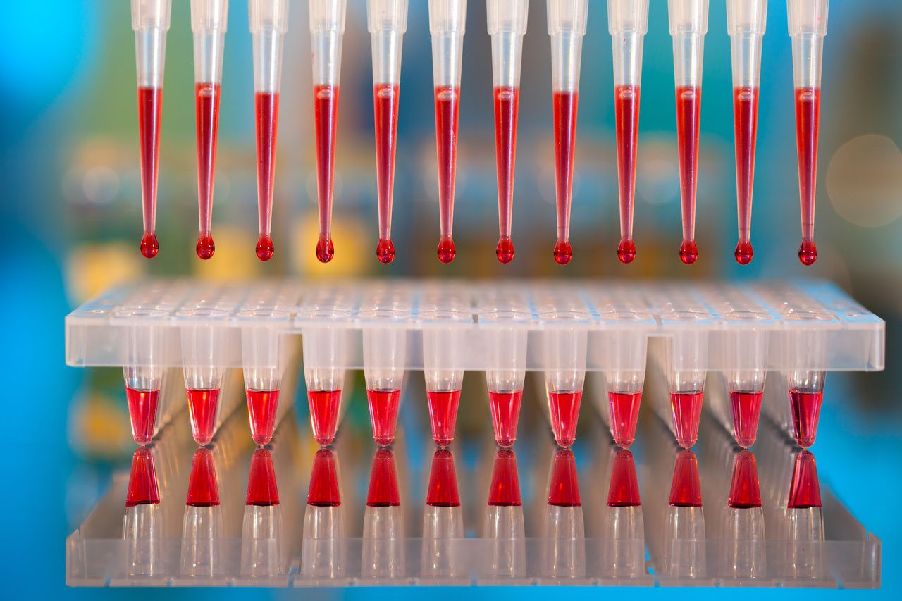 FCM, NGS, and PCR, Oh My! Detecting MRD in Patients With Acute Lymphoblastic Leukemia