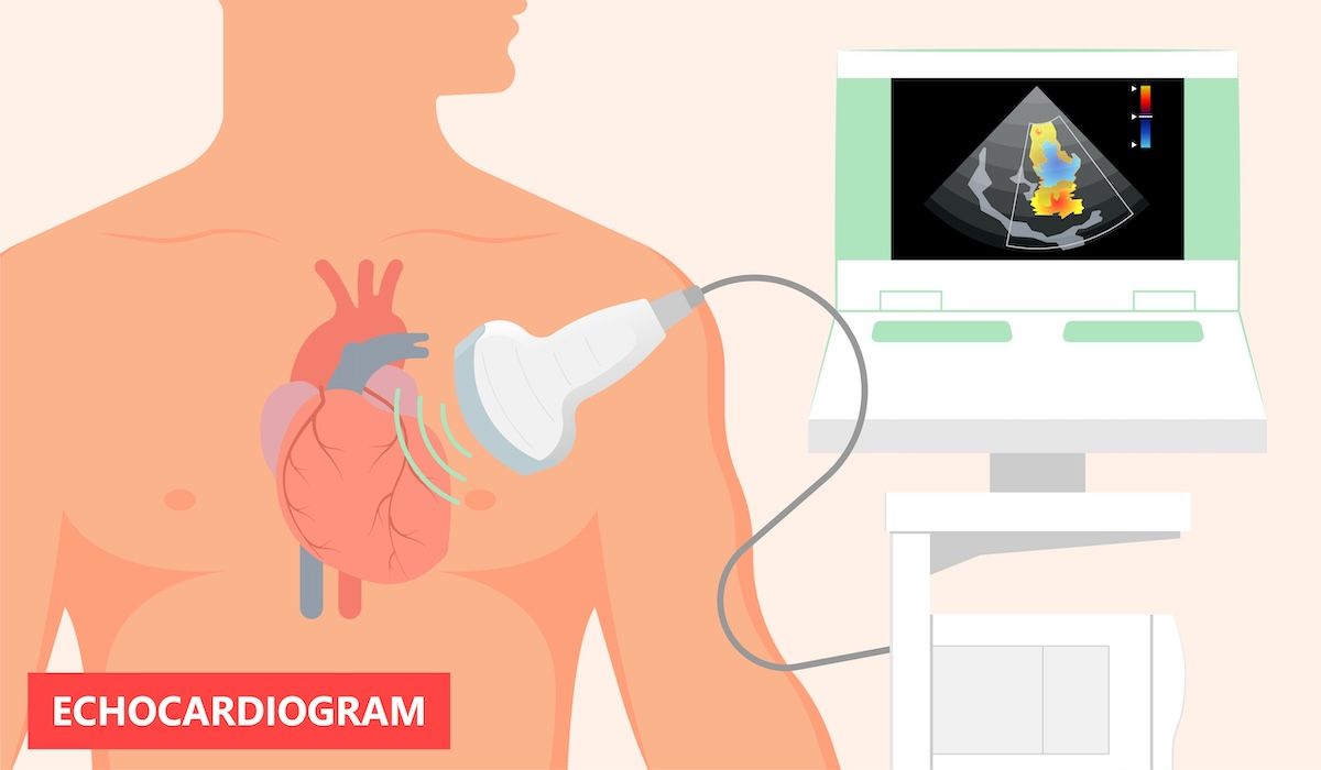 echocardiogram | Image Credit: © Pepermpron-stock.adobe.com