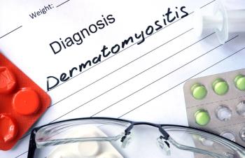 Dermatomyositis | Image credit: Vitalii Vodolazskyi - stock.adobe.com