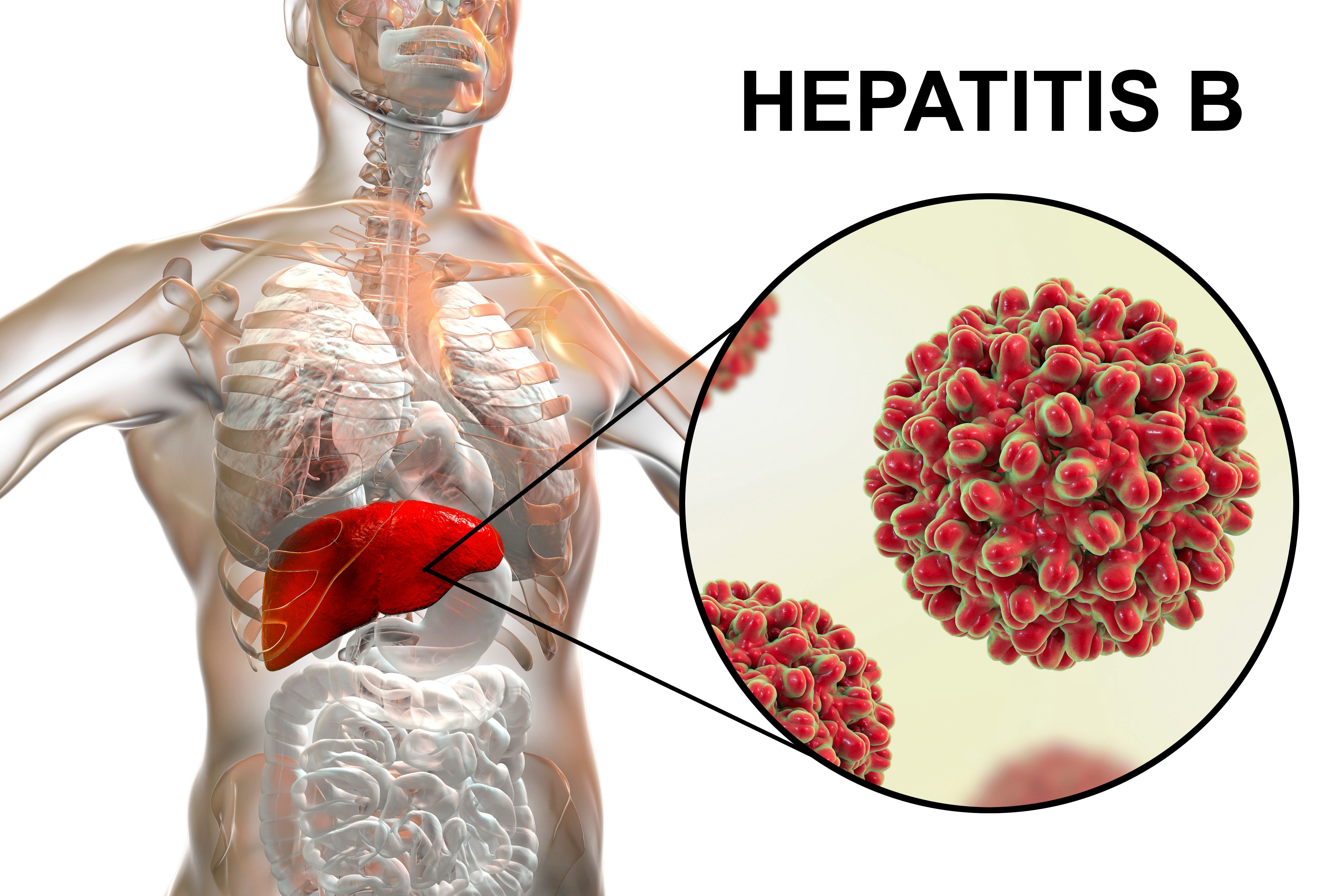 La vida de los pacientes afectada física, social y emocionalmente por la hepatitis B