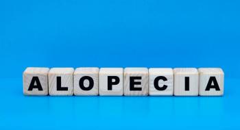 Alopecia on cubes, blue background | Image Credit:  Zhanna - stock.adobe.com