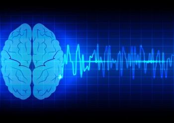 brain image 
