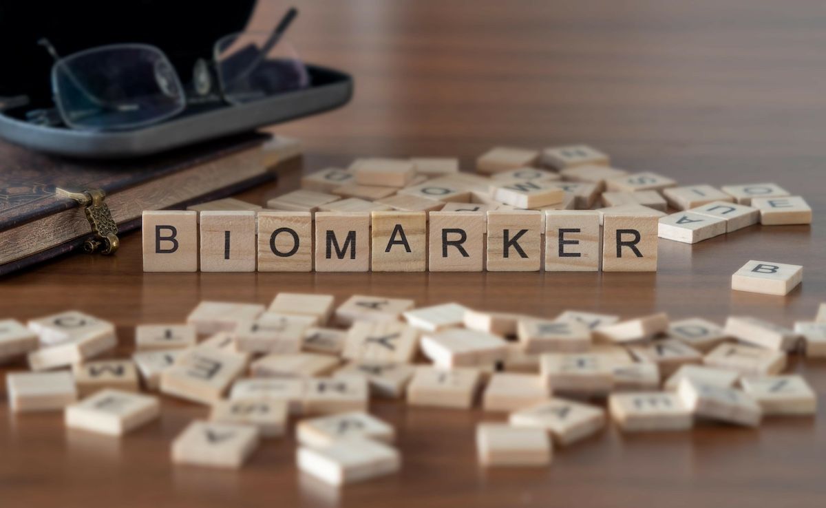 Biomarker Scrabble tiles | Image Credit: © lexiconimages-stock.adobe.com