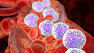 3D illustration showing abundant lymphoblasts in blood | Image credit: Dr_Microbe - stock.adobe.com