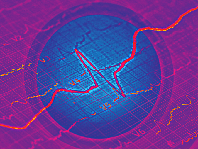 image of brain wave