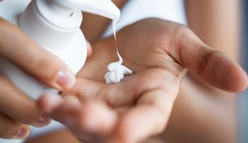 hand eczema lotion psoriasis | Image credit: Yakobchuk Olena - stock.adobe.com