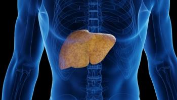 Fatty liver | Image Credit: © Sebastian Kaulitzki-stock.adobe.com