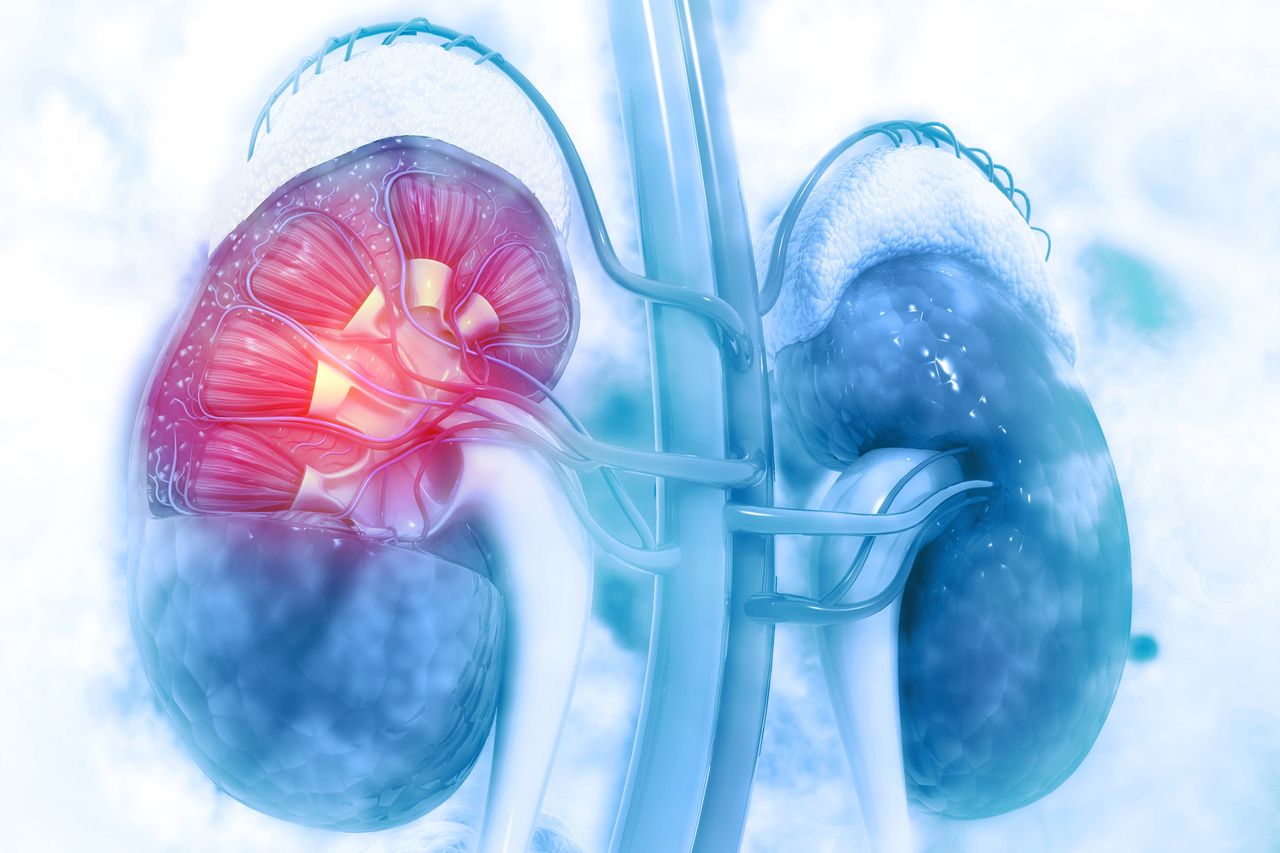 FDA Approves Canagliflozin to Prevent Kidney Failure, Hospitalization for Heart Failure