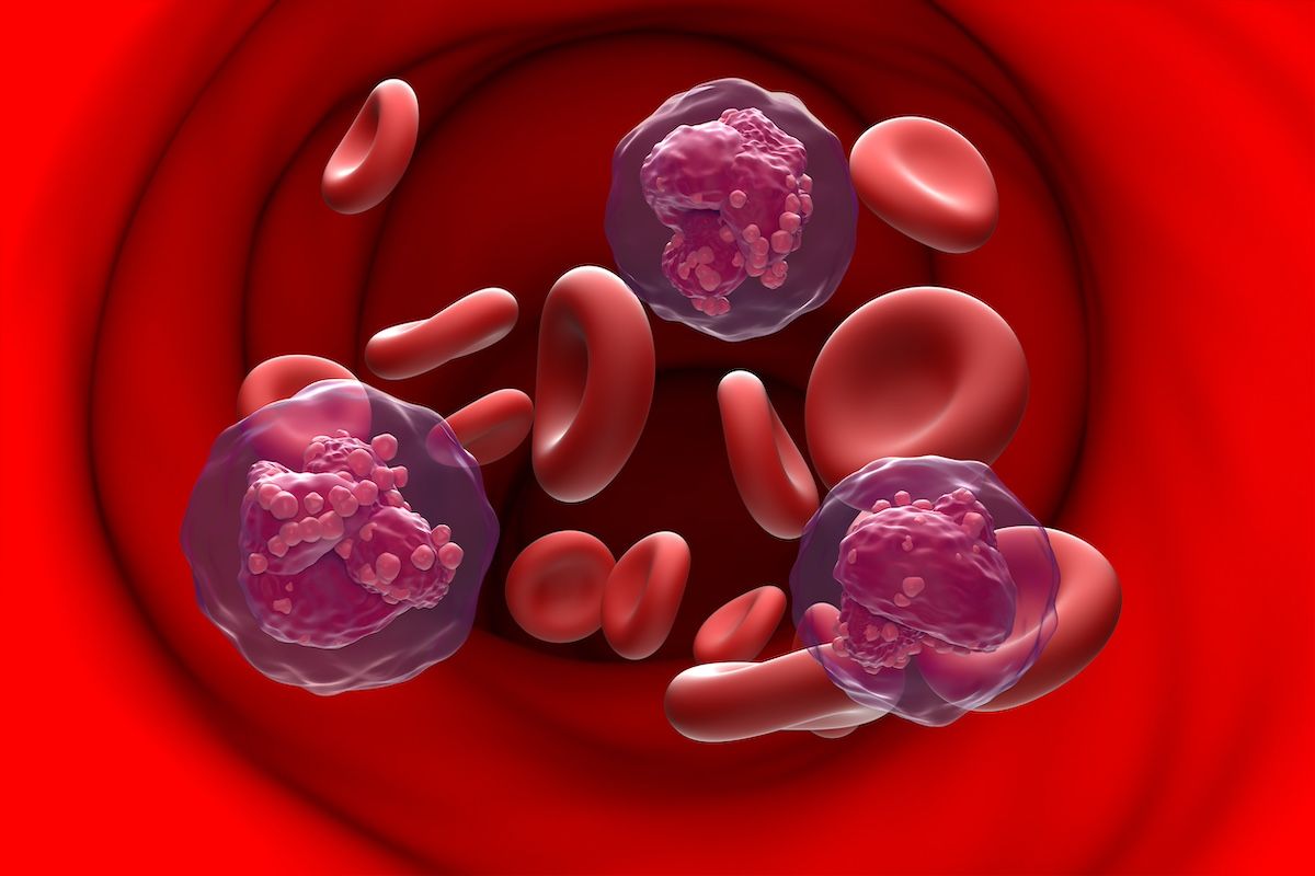ALL cancer cells in blood flow | Image Credit: Laszlo-stock.adobe.com