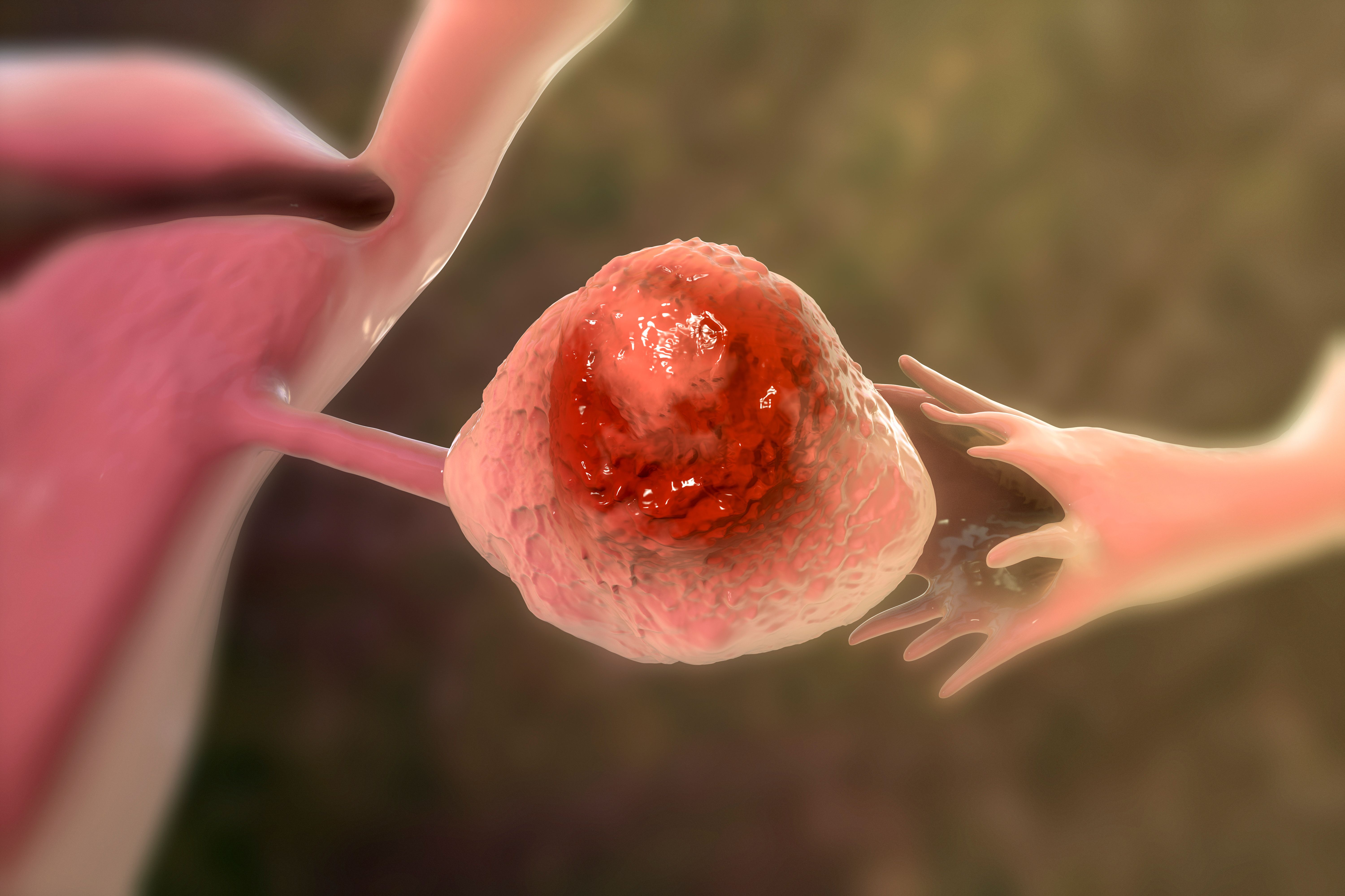 Ovarian cancer animation | Image Credit: Dr_Microbe - stock.adobe.com